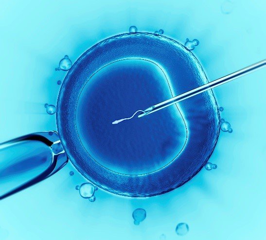 IVF Treatment